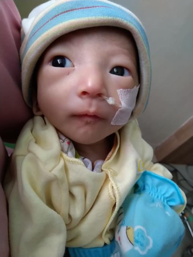 A small baby with a feeding tube in his nose