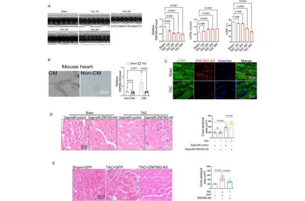 lncRNA ZNF593-AS inhibits cardiac hypertrophy and myocardial remodeling by upregulating Mfn2 ex<em></em>pression