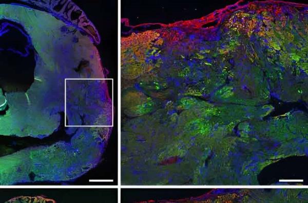 Research team discovers how Copaxone protects the heart muscle and improves its function after heart attack