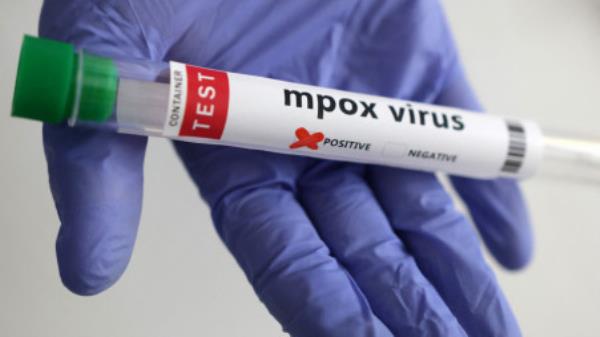 A test tube labelled &quot;Mpox virus positive&quot; is held in this illustration taken August 20, 2024. REUTERS/Dado Ruvic/Illustration/File Photo